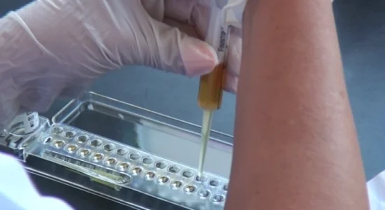 Vdes një 75-vjeçare nga gripi në Shkup, rritet numri i të hospitalizuarve