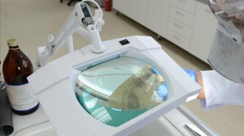 Dritë jeshile për mjetin e kompanisë AliBaba për zbulimin e kancerit me inteligjencë artificiale
