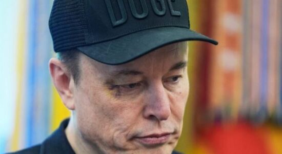 Çuditë Elon Musk, shfaqet me një sy të nxirë gjatë konferencës lamtumirëse me Donald Trump