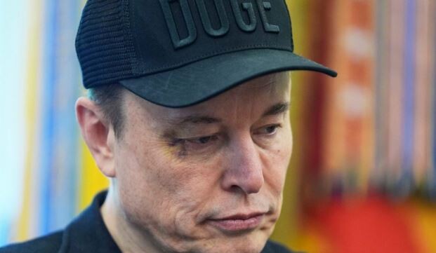 Çuditë Elon Musk, shfaqet me një sy të nxirë gjatë konferencës lamtumirëse me Donald Trump