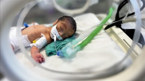 Foshnjat e lindura para kohe në Gaza luftojnë për mbijetesë
