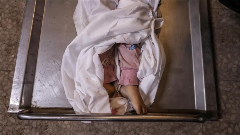Gaza, 10 palestinezë vdesin nga uria në 24 orët e fundit