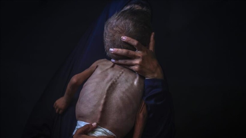 Gaza përballet me vdekjen masive të afërt të 100 mijë fëmijëve për shkak të mungesës së formulës për foshnja