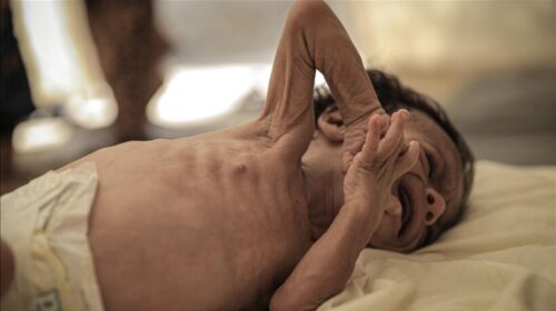 Gaza, 40 mijë foshnje dhe 250 mijë fëmijë janë në rrezik të vdesin nga uria