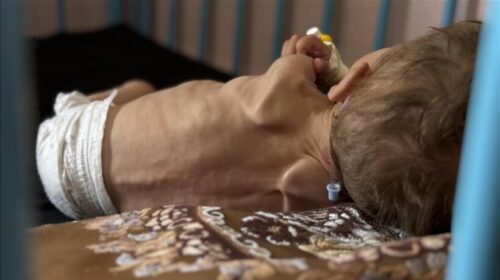 Rritet në 300 numri i të vdekurve nga uria në Rripin e Gazës, 117 prej tyre janë fëmijë