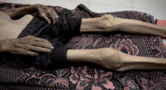 Shkon në mbi 260 numri i të vdekurve nga uria në Gaza