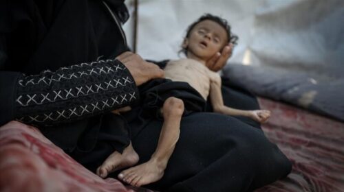11 palestinezë të tjerë vdesin nga uria gjatë 24 orëve të fundit në Rripin e Gazës
