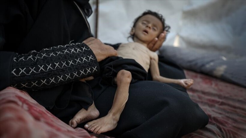 11 palestinezë të tjerë vdesin nga uria gjatë 24 orëve të fundit në Rripin e Gazës