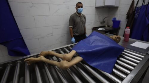 Gaza, 10 palestinezë vdesin nga uria në 24 orët e fundit