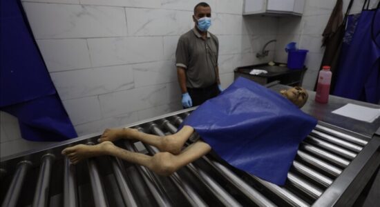 Gaza, 10 palestinezë vdesin nga uria në 24 orët e fundit