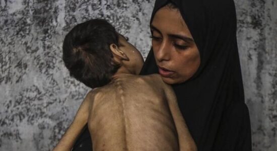Në 24 orët fundit në Gaza vdesin nga uria 6 persona të tjerë, përfshirë dy fëmijë
