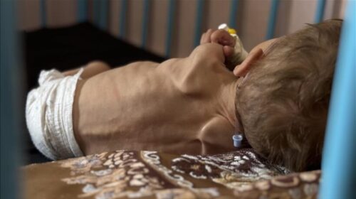 Pesë palestinezë të tjerë vdesin nga uria në Gaza, shifra e përgjithshme rritet në 387