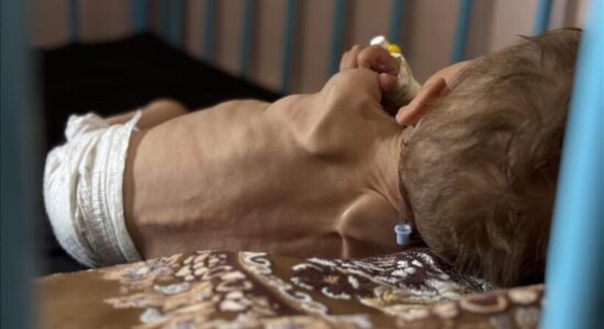 Pesë palestinezë të tjerë vdesin nga uria në Gaza, shifra e përgjithshme rritet në 387