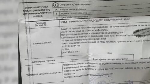 E pazakontë, miu kafshon një fëmijë të moshës 10 vjeçare në Shkup