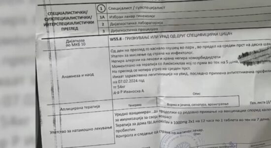 E pazakontë, miu kafshon një fëmijë të moshës 10 vjeçare në Shkup