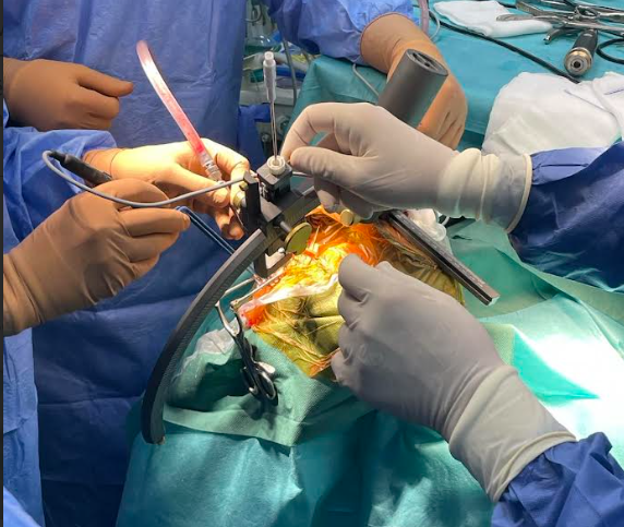 Aliu – Agai: Në Klinikën e Neurokirurgjisë në Shkup për herë të parë u krye një operacion në tru me ndihmën e sistemit të stereotaksisë