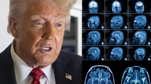Trump i nënshtrohet një skanimi MRI, ngrit pyetje mbi shëndetin e tij