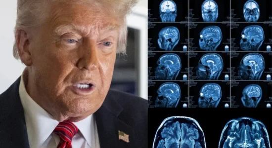 Trump i nënshtrohet një skanimi MRI, ngrit pyetje mbi shëndetin e tij