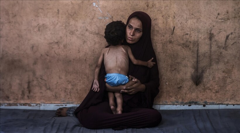 OKB-ja raporton gati 95.000 raste të kequshqyerjes së fëmijëve në Rripin e Gazës në vitin 2025