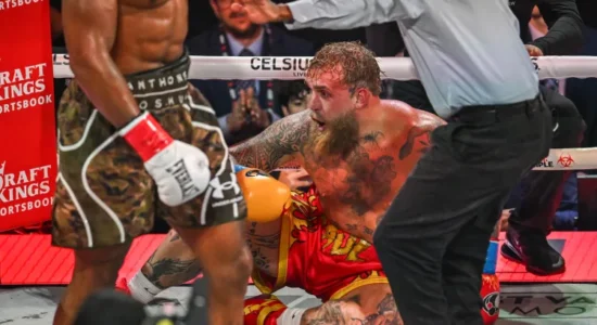 Jake Paul pezullohet pa afat pas dëmtimit të nofullës dhe operacionit, karriera si boksier në rrezik