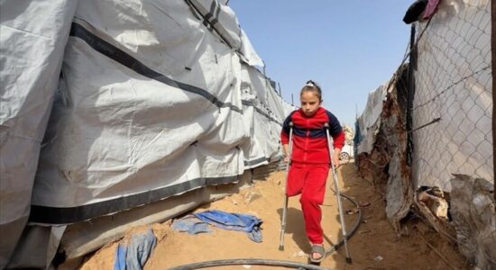 Vajza palestineze humbi familjen dhe këmbën në sulmin e Izraelit në Gaza, ëndërron të ecë përsëri