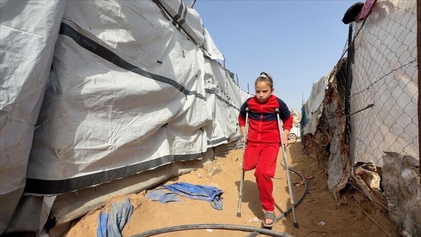 Vajza palestineze humbi familjen dhe këmbën në sulmin e Izraelit në Gaza, ëndërron të ecë përsëri