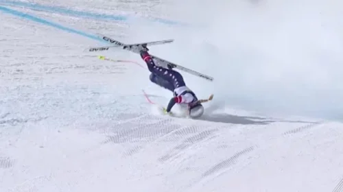 Vonn flet për herë të parë pas rënies së tmerrshme, zbulon se do të përballet me disa operacione