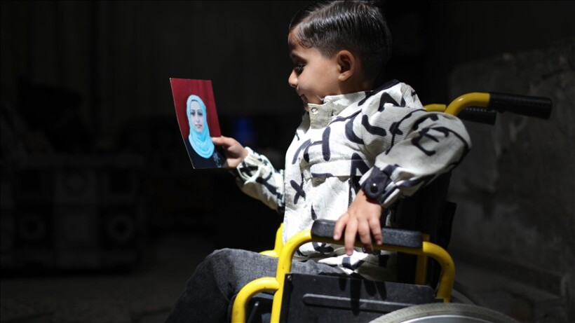 Shtatëvjeçari i paralizuar nga një sulm izraelit lufton për t’u rikuperuar në Gaza