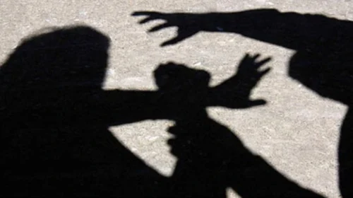 Sulm ndaj dy të rinjve në Tetovë, policia po heton rastin