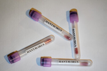 Hantavirus