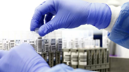 SHBA publikon të dhëna për laboratorë biologjikë në mbi 30 vende