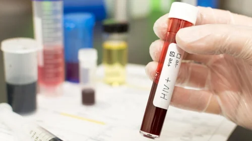 Në korrik janë regjistruar 11 raste të reja me HIV/AIDS, më i riu është 20-vjeç