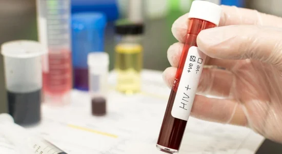 Në korrik janë regjistruar 11 raste të reja me HIV/AIDS, më i riu është 20-vjeç