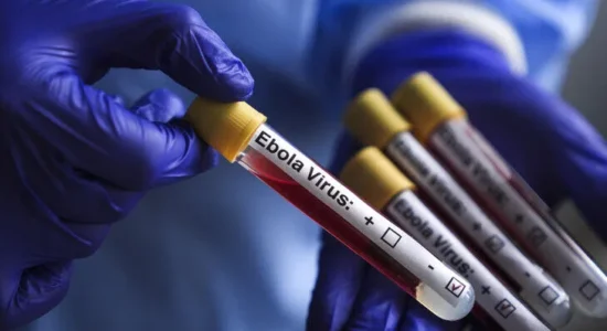 OBSH: Rastet dhe vdekjet nga Ebola bien në RD të Kongos, por transmetimi mbetet i lartë