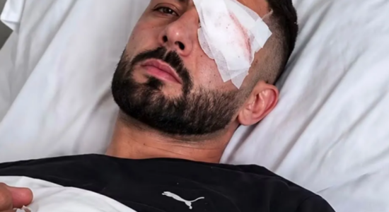 Erjon Vishkulli kalon me sukses operacionin, ndërhyrja i shpëton syrin