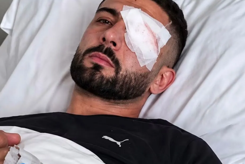 Erjon Vishkulli kalon me sukses operacionin, ndërhyrja i shpëton syrin